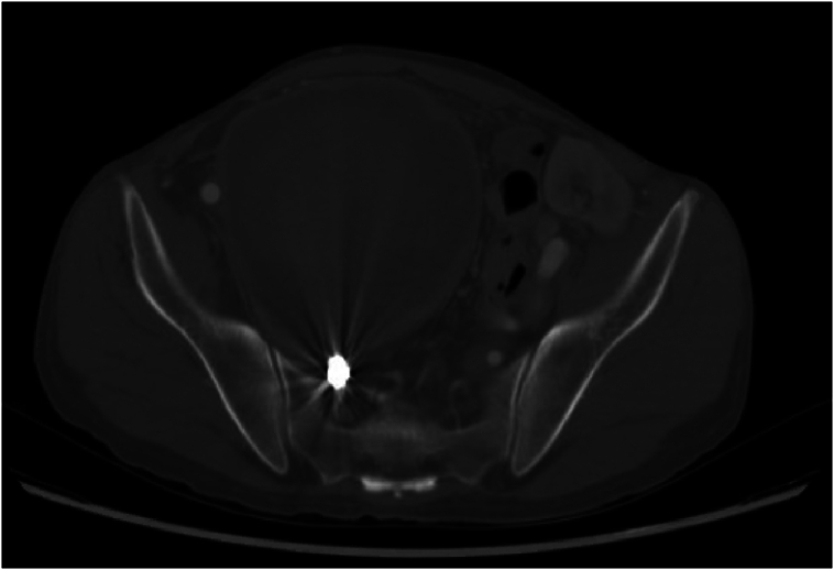 Fig. 3