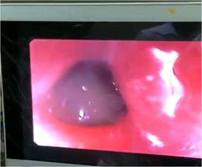 graphic file with name 12664_2020_1133_Figc_HTML.jpg