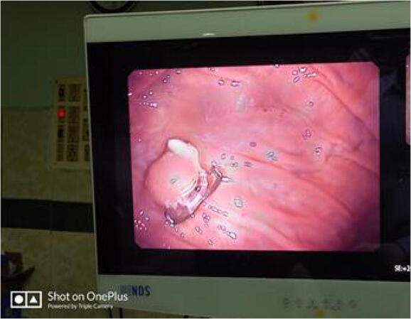 graphic file with name 12664_2020_1133_Figd_HTML.jpg