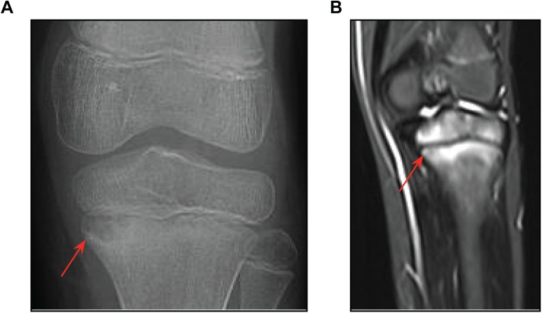 Fig 1