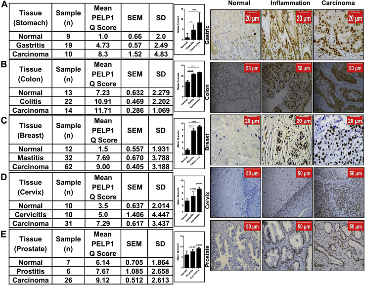 Figure 11