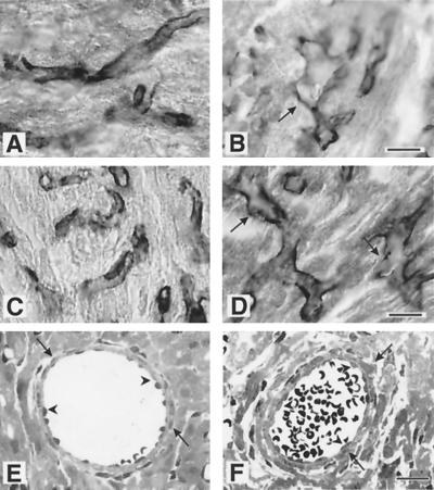 FIG. 8