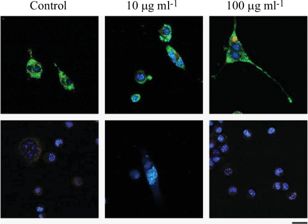 Representative fluorescence confocal images of the intracellular effect of MNP exposure.