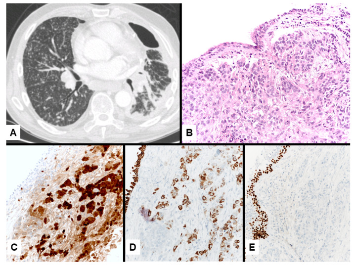 Figure 6