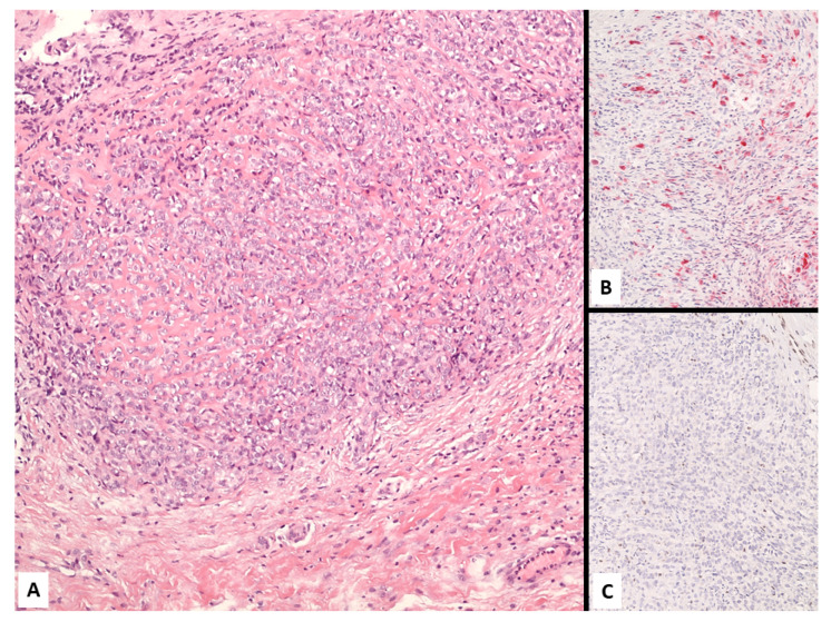 Figure 16