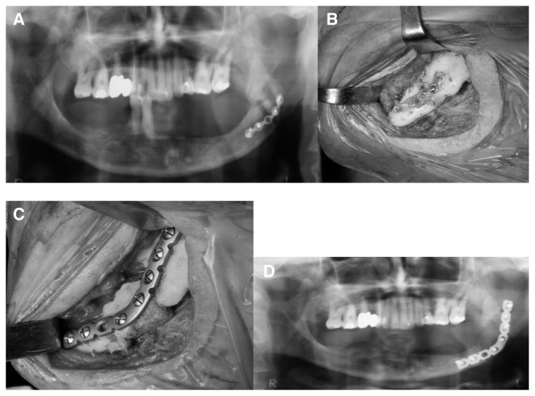 Fig. 4 A, B, C, D