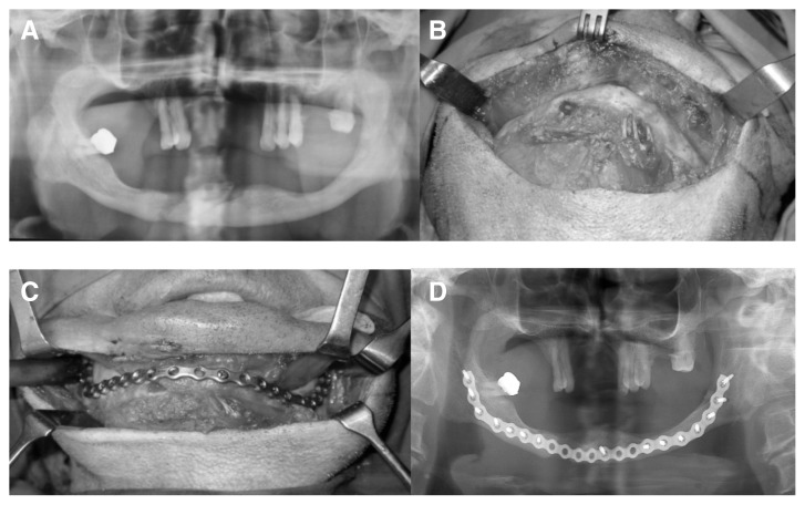 Fig. 1 A, B, C, D