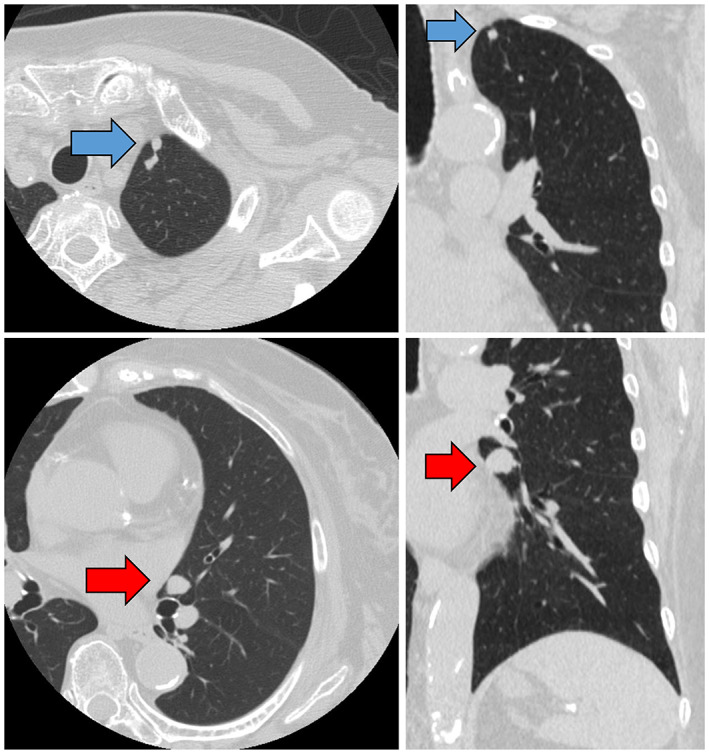 FIGURE 1