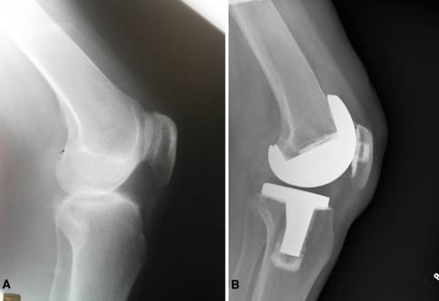 Fig. 3A–B