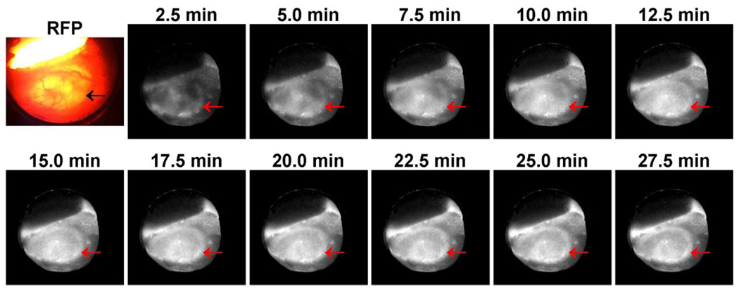 Fig. 10