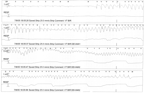 Figure 2)