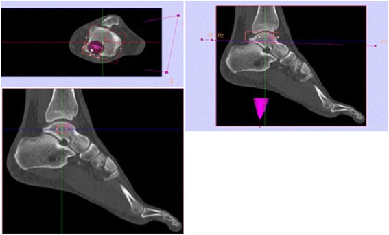 Fig. 4