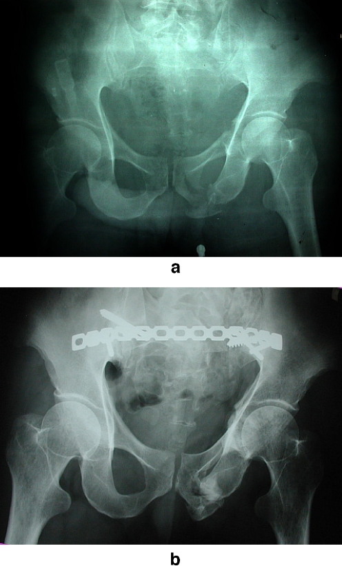 Fig. 2