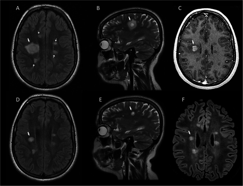 Fig. 2