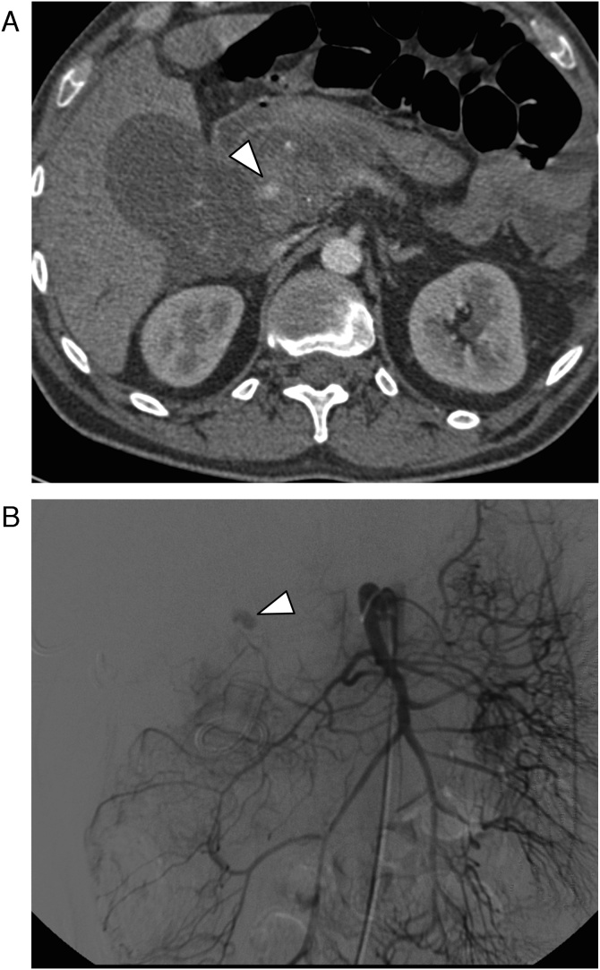 Fig. 4