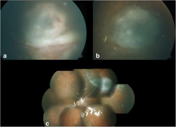 Fig. 3