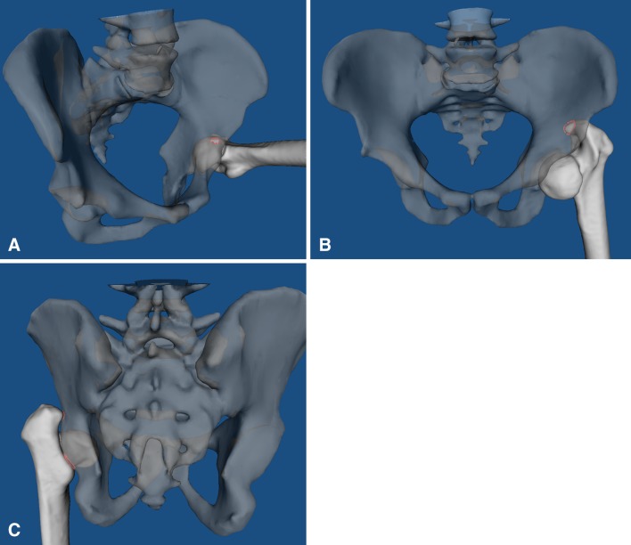 Fig. 4A–C