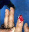 Fig. 3b