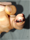 Fig. 6
