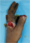 Fig. 4a