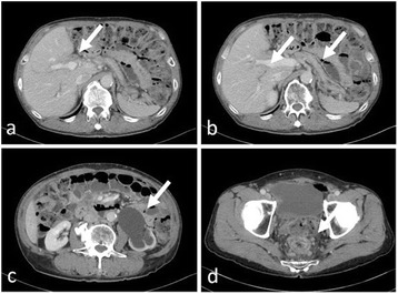 Fig. 1