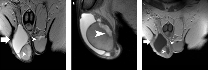 Figure 3 a–c