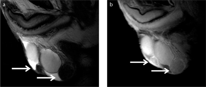 Figure 12 a, b