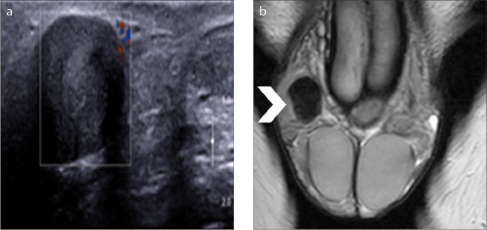 Figure 13 a, b