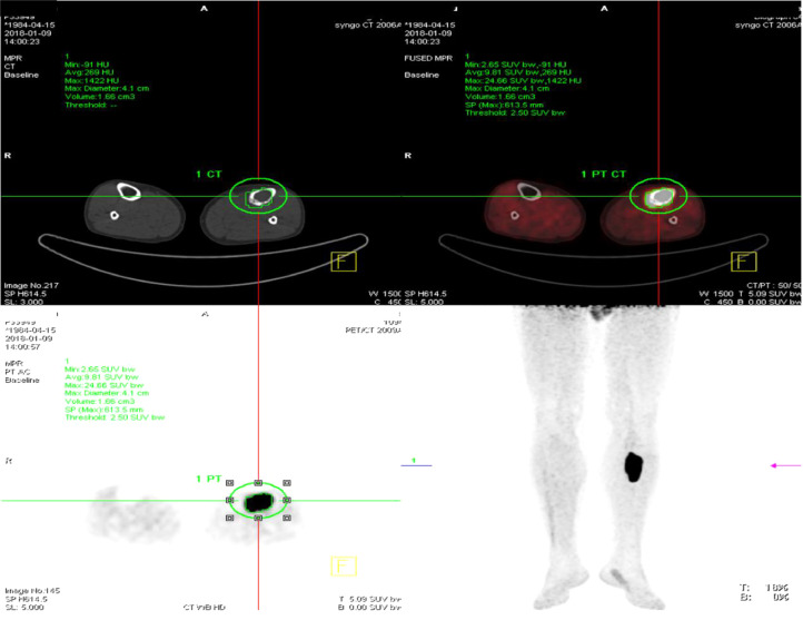 Fig 4