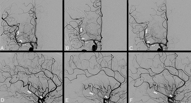 Fig 3.