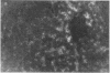 252
