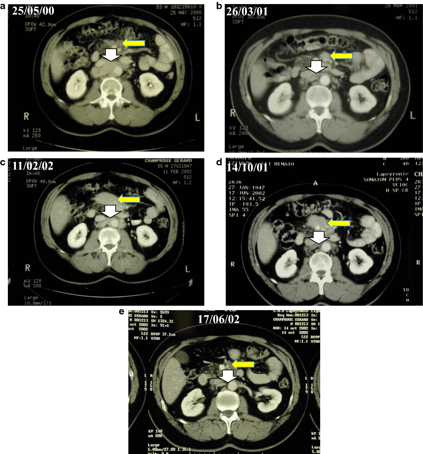 Fig. 4