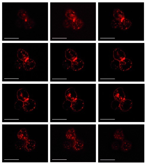 graphic file with name rna-9-67-g7.jpg