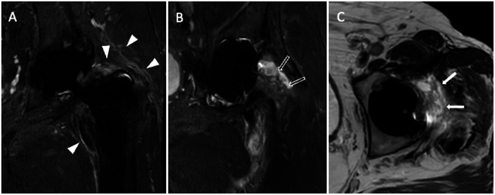 Fig. 12