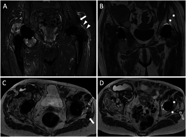 Fig. 10