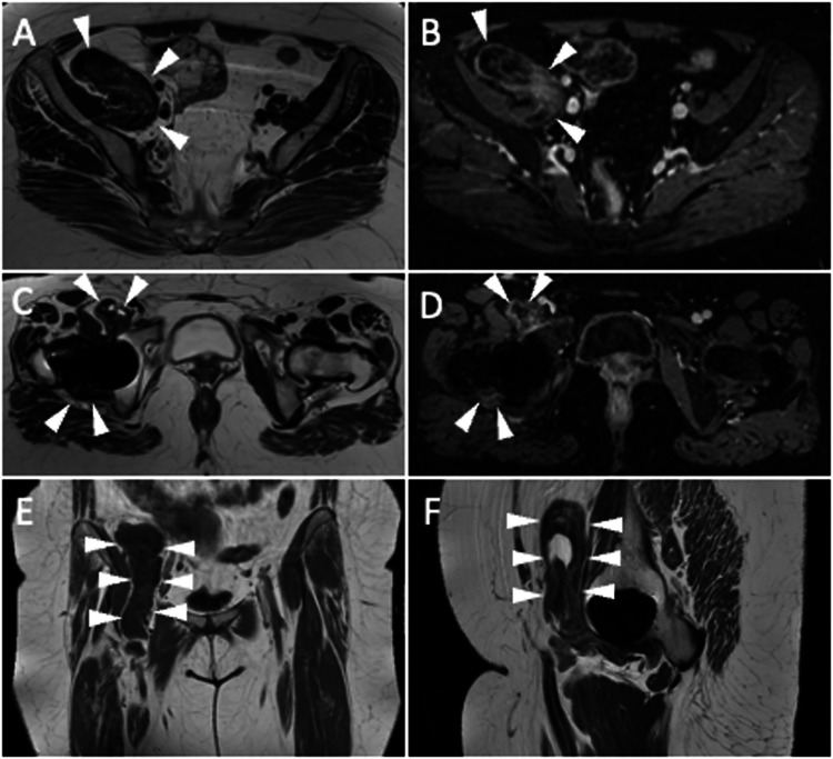 Fig. 9