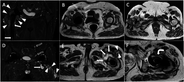 Fig. 11