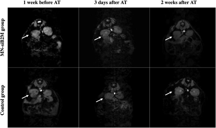 FIG. 3.