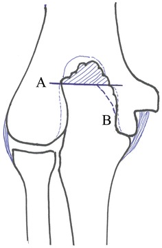 Fig. 5