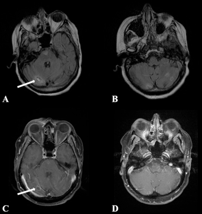 Fig. 12