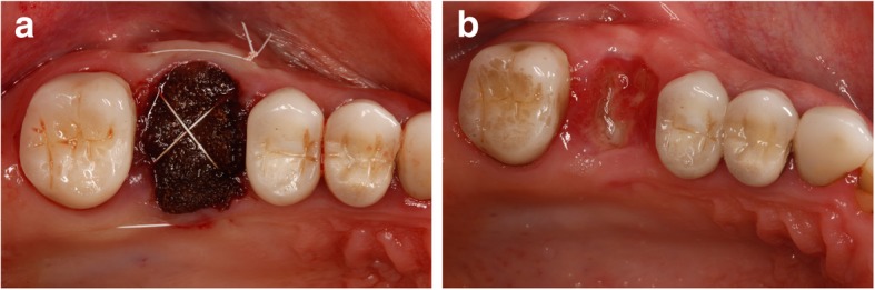 Fig. 11