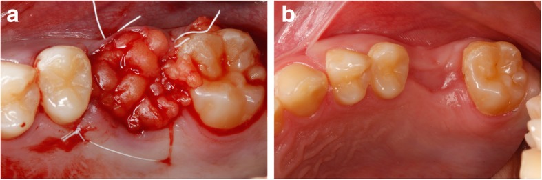 Fig. 10