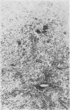 346