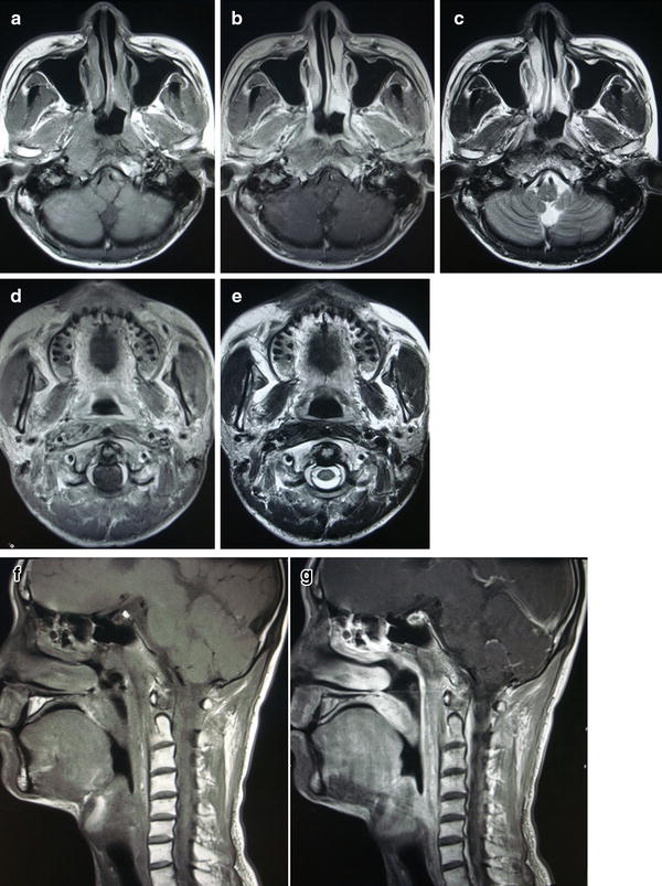 Fig. 3