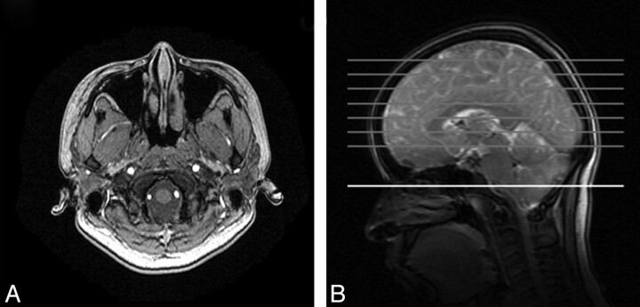 Fig 1.