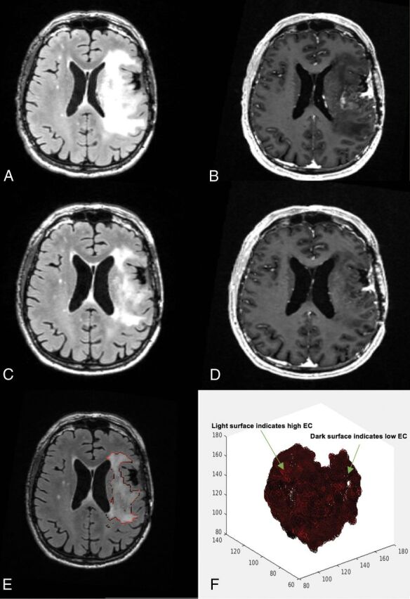 Fig 1.