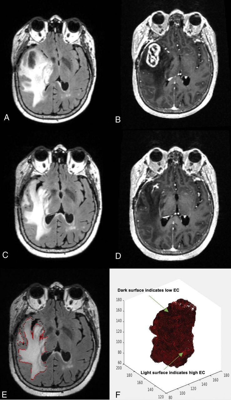 Fig 2.