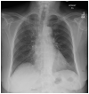 Image 4.