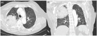 Image 2.