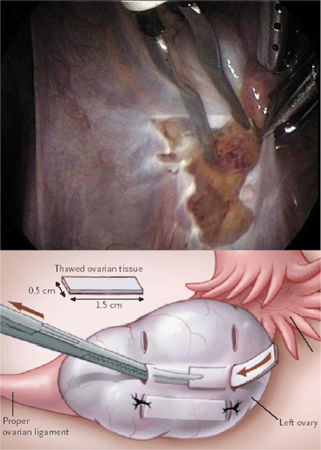 Fig. 3